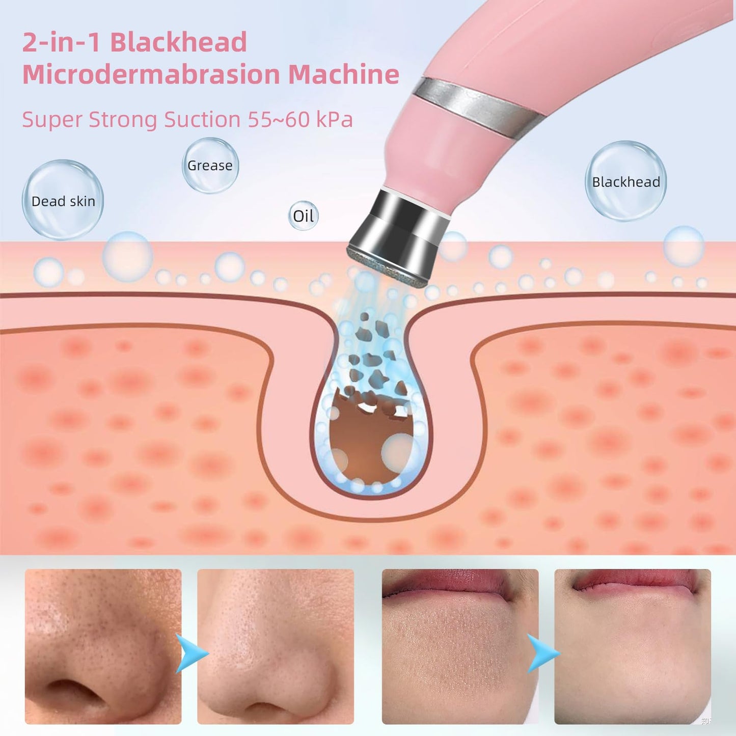 IeBilif Diamond Microdermabrasion Machine, 3 Modes Diamond Microdermabrasion Dermabrasion Machine for Blackhead Removal, Professional Portable Home Travel Microdermabrasion Device