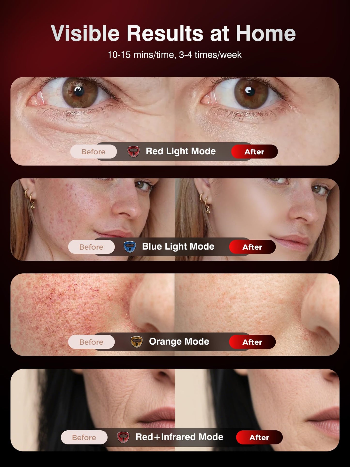Red Light Therapy for Face，4D Red Light Therapy Mask with 4 Color Light Modes (Red+Infrared/Red/Blue/Orange), 850NM Infrared LED Face Mask Light Therapy with 4000mAh Rechargeable Remote, Timer