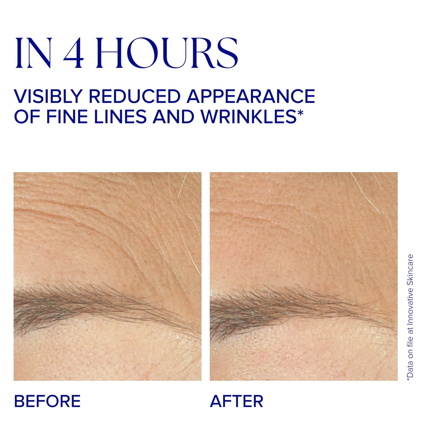 IS CLINICAL Youth Complex, An Anti-aging, Formula Boosts Collagen and Elastin Production Anti-wrinkle and Firms Skin