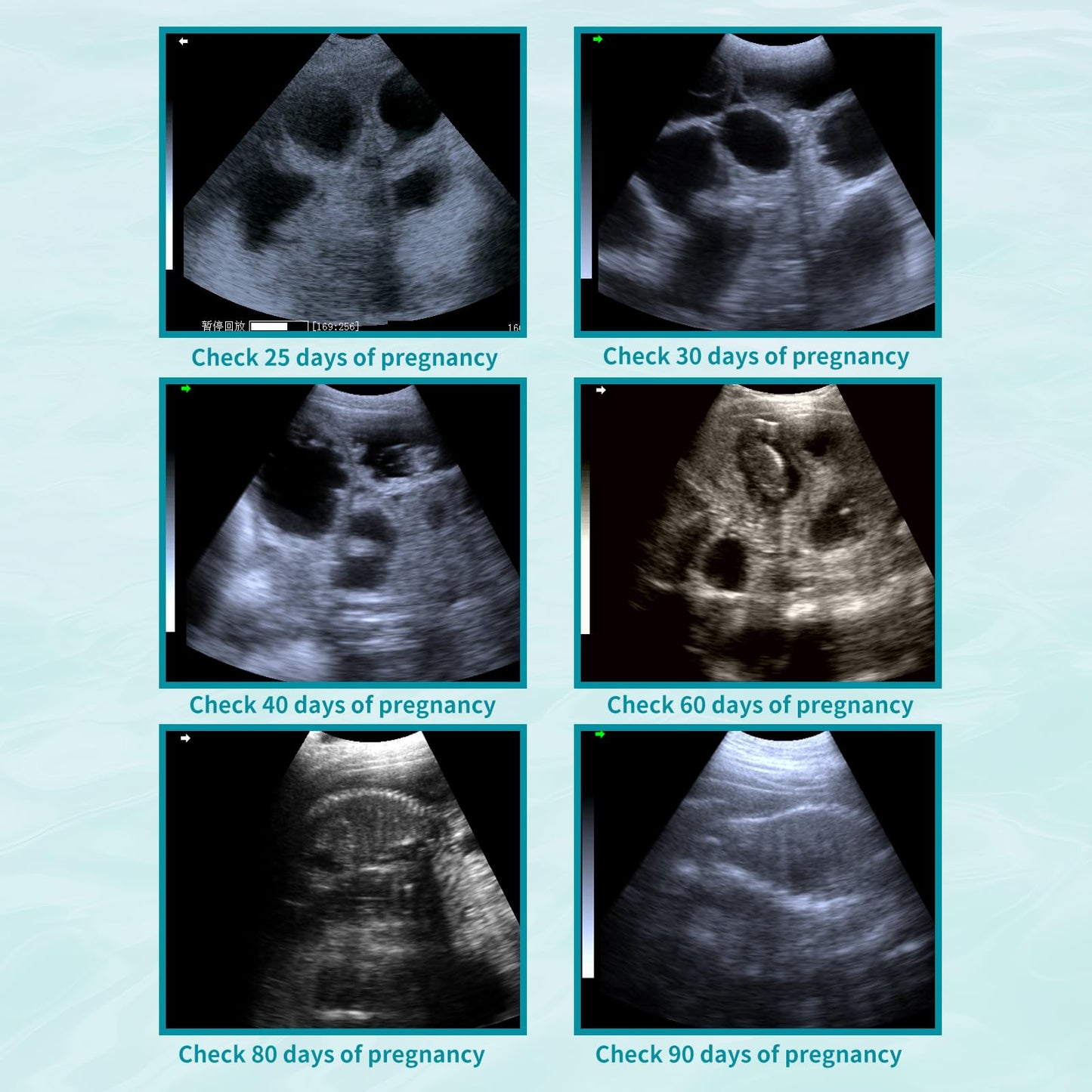 A8 Professional Veterinary Ultrasound Machine for Animal Pregnancy Check, Beginner-Friendly Handheld Scanner with 3.5MHz Waterproof Convex Probe, Clear Imaging for Dogs, Sheep, Pigs & Small Farms