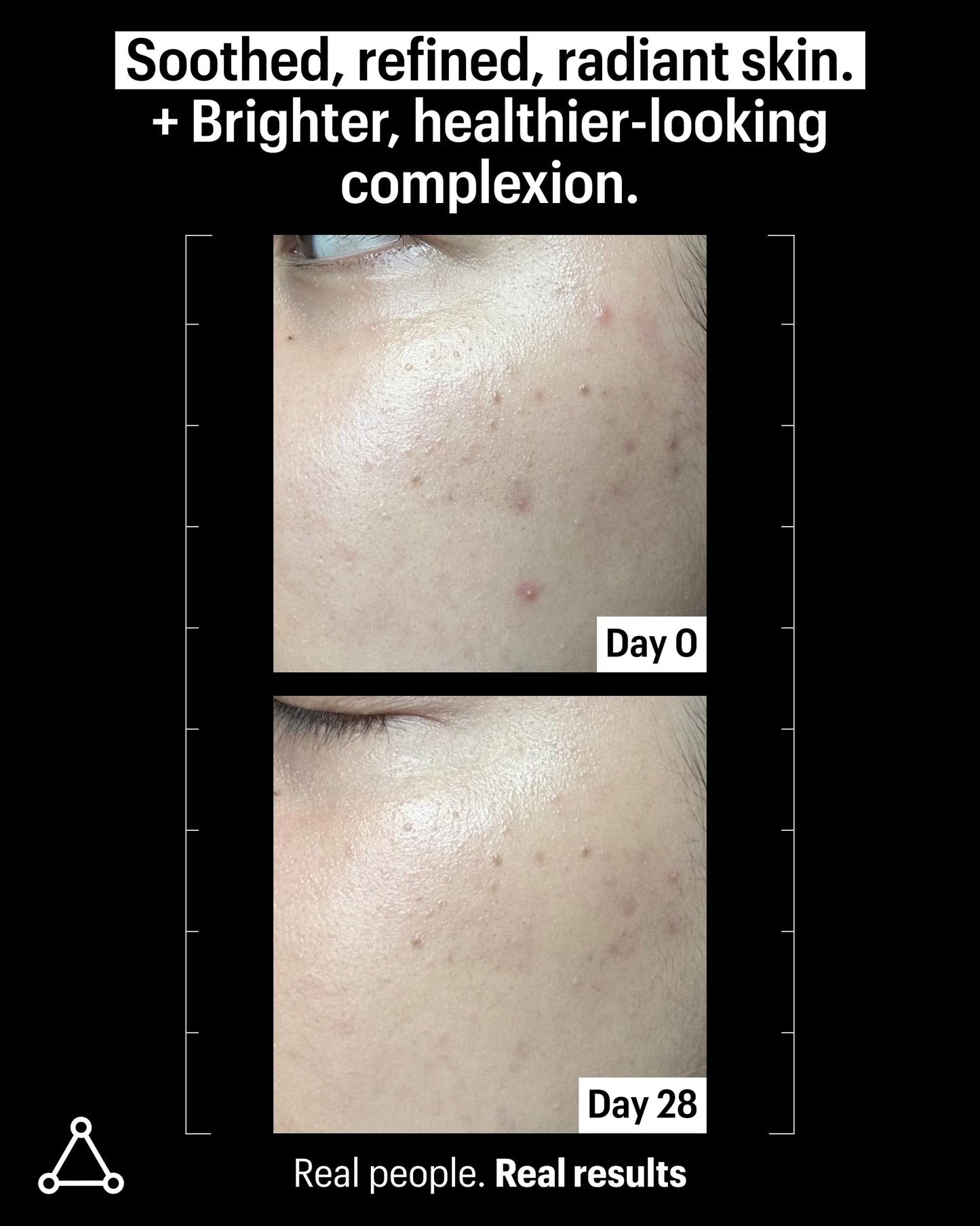 Allies of Skin 20% Vitamin C Serum | Daily Glow & Firming Face Serum | Lightweight Waterless Formula Treats Uneven Tone & Spots | Anti-Aging Support for Smooth, Radiant Skin | 1 fl oz