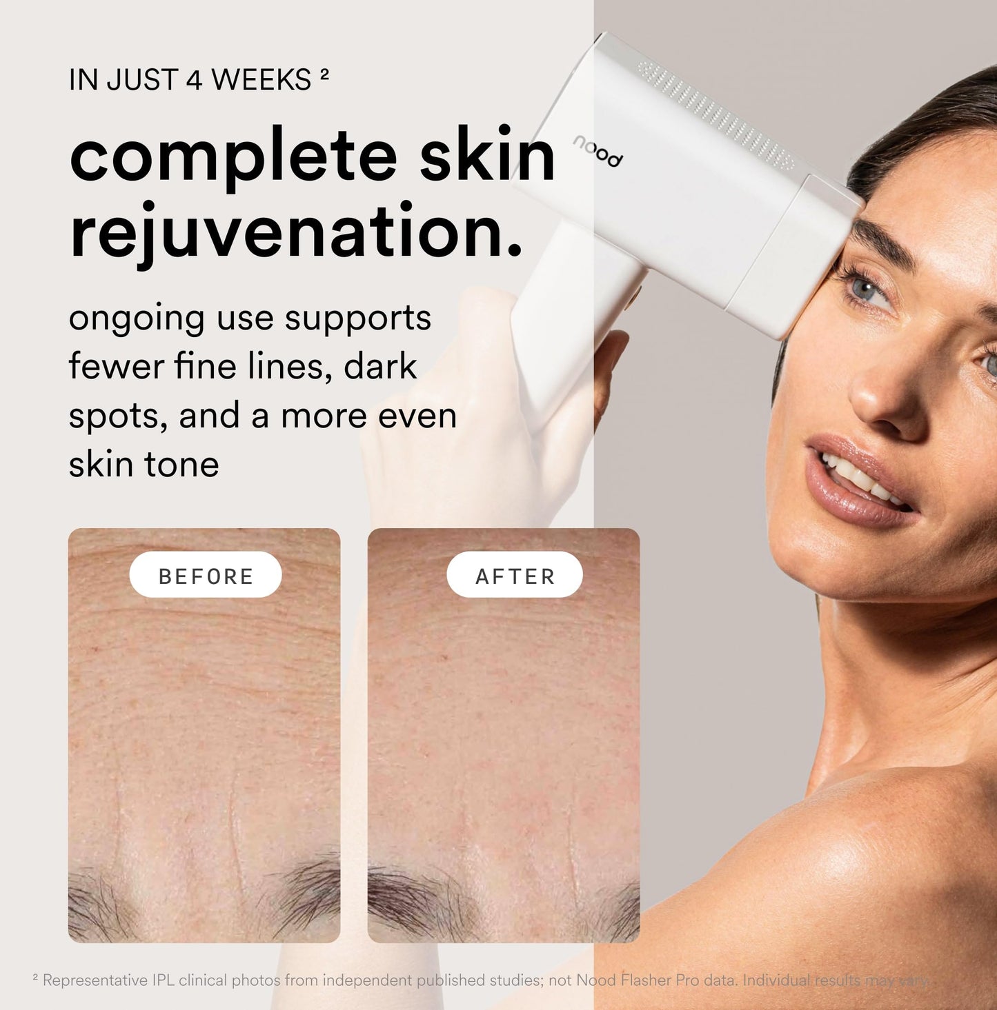 Nood™ NEW Flasher Pro + Slow-Grow Serum — IPL Laser Hair Removal Device for Women & Men + After Shave Serum to Slow Hair Regrowth While Reducing Ingrown Hair & Skin Irritation — Gloss White