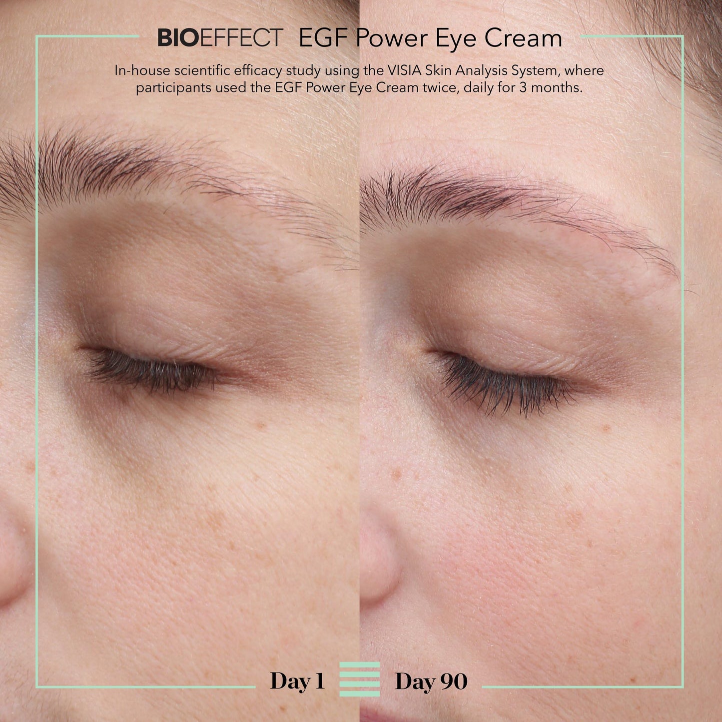 BIOEFFECT EGF Power Eye Cream | Intensive Age-Defying Eye Treatment with Epidermal Growth Factor + Bakuchiol + Niacinamide for Wrinkles, Dark Circles & Puffiness | 15 mL / 0.51 oz