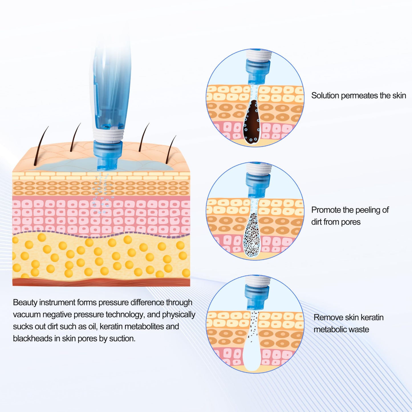 Facial Dermabrasion Machine Dermabrasion Skin Peel Water Machine (ETWD007)